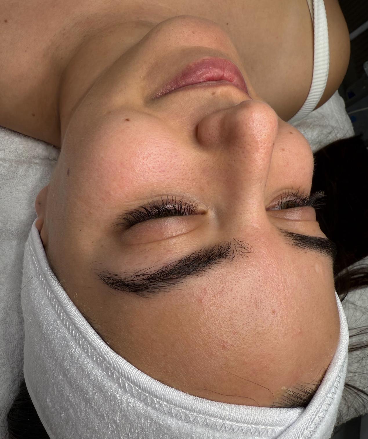 לפני טיפול פנים קלאסי