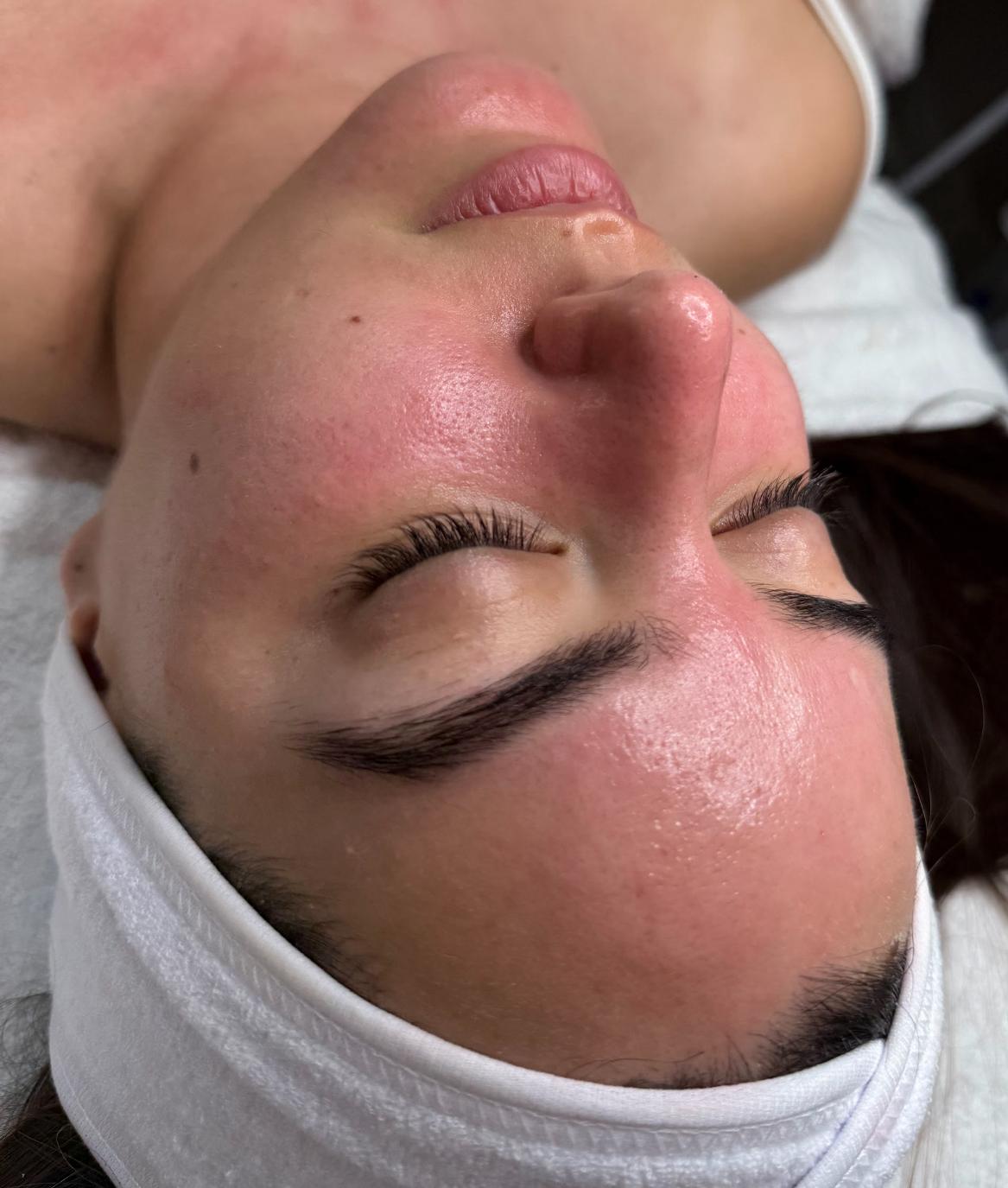 טיפול פנים קלאסי