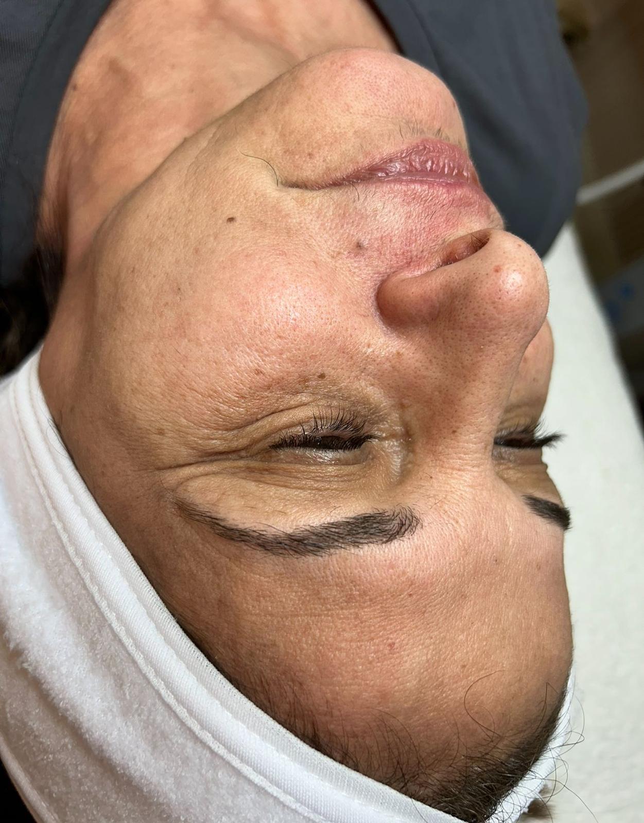 לפני אנטי אייג'ינג