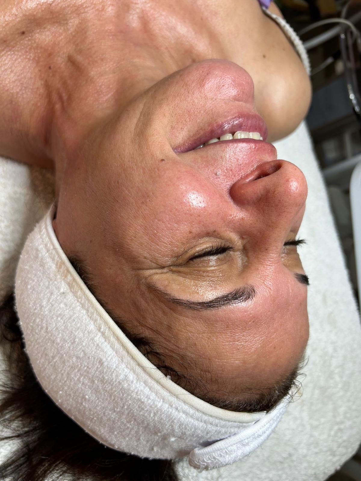 אחרי אנטי אייג'ינג