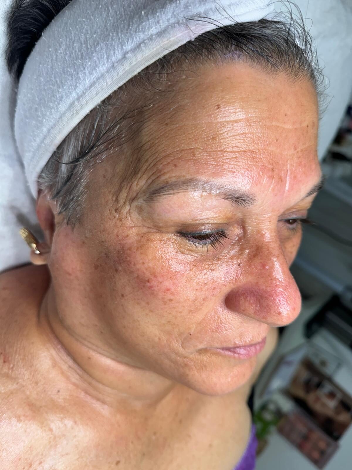 אנטי אייג'ינג