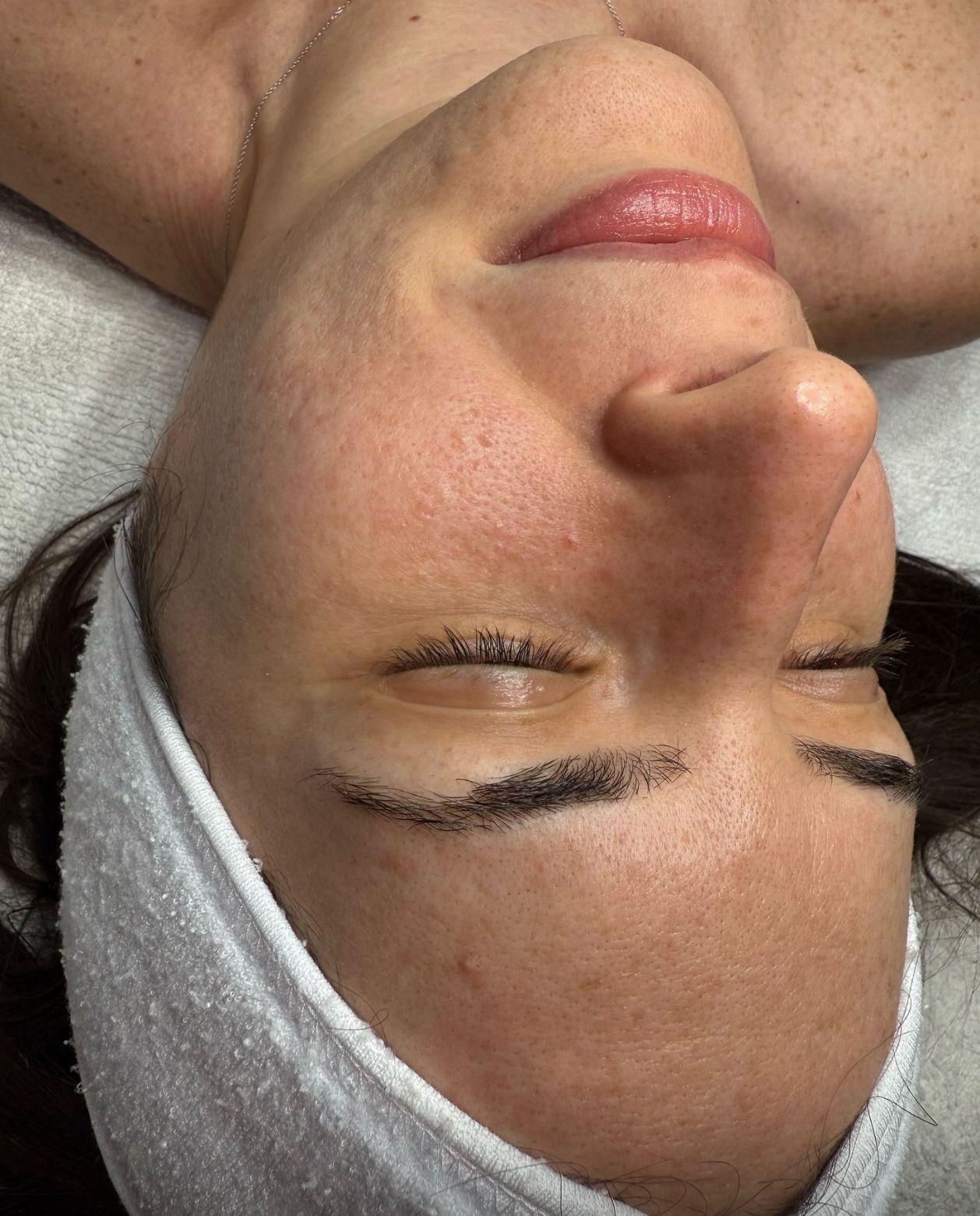 לפני טיפול פנים קלאסי